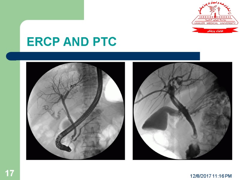 ERCP AND PTC 12/8/2017 11:16 PM 17